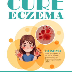 Cure Eczema